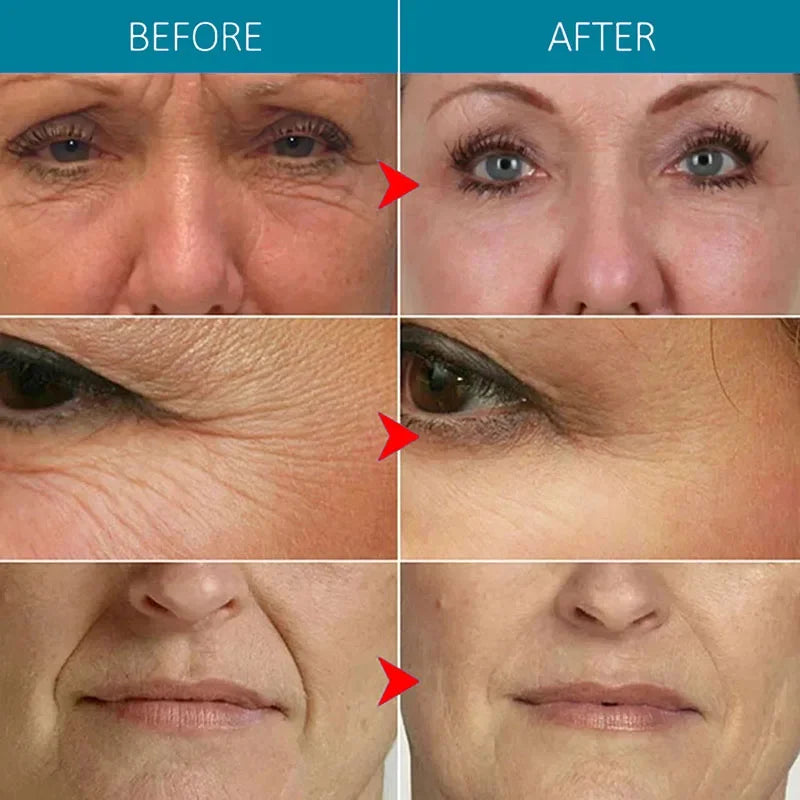 Rejuvenescedor Em Capsulas